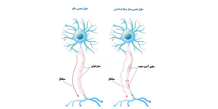 ام اس